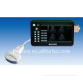 3.5 Mhz Convex Probe B / W 7" Tft Lcd One Connector Palm Ultrasound Scanner